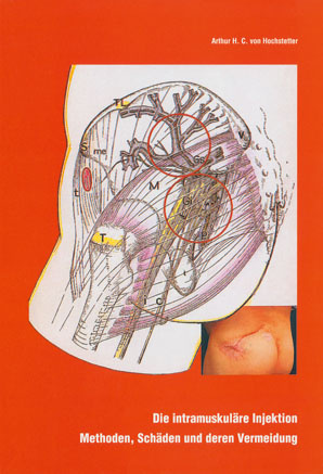 Die intramuskuläre Injektion - ihre Schäden und deren Vermeidung